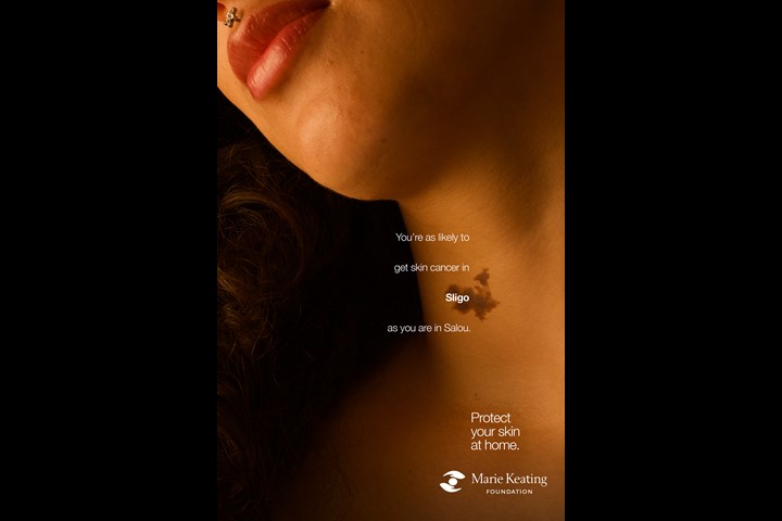Mole Maps - Skin Cancer - The Marie Keating Foundation