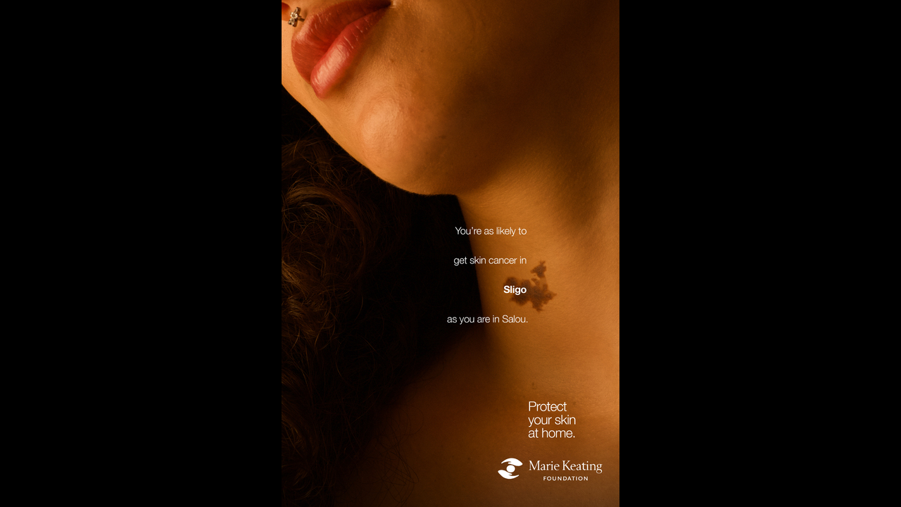 Mole Maps - Skin Cancer - The Marie Keating Foundation