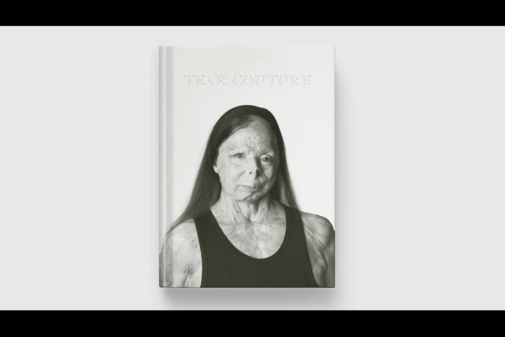 Tear Couture LookBook - Charity - Acid survivors Trust International (ASTI)