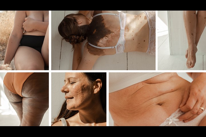 Canvas of Life - Female hair removal - Gillette Venus