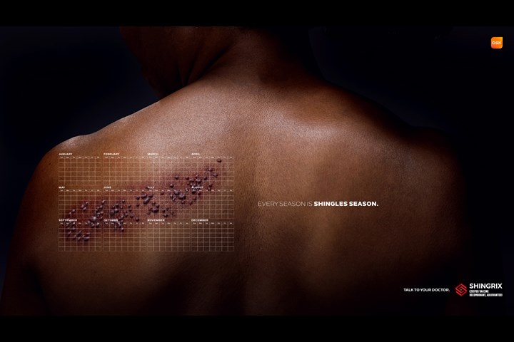 Shingles Season - SHINGRIX (Adult Shingles Vaccine) - GSK Vaccines - SHINGRIX