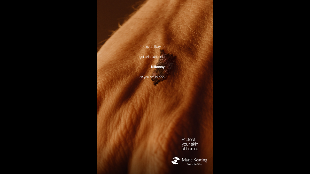 Mole Maps - Skin Cancer - The Marie Keating Foundation