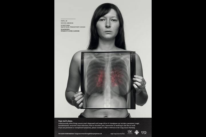 Lung Cancer 'See through the Symptoms' - Engine Creative - Design for good