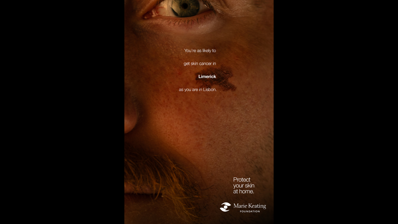 Mole Maps - Skin Cancer - The Marie Keating Foundation