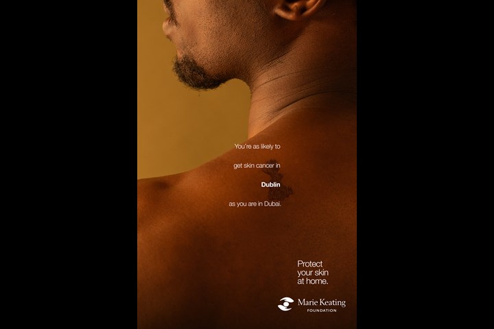 Mole Maps - Skin Cancer - The Marie Keating Foundation