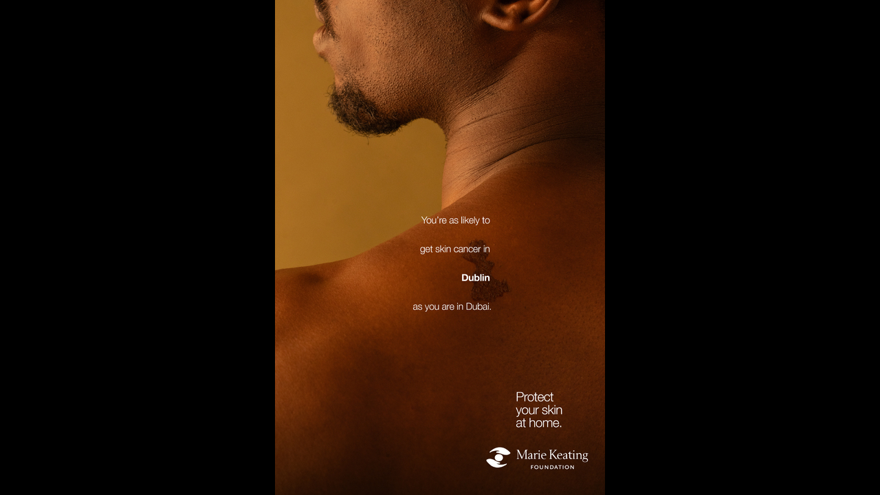 Mole Maps - Skin Cancer - The Marie Keating Foundation
