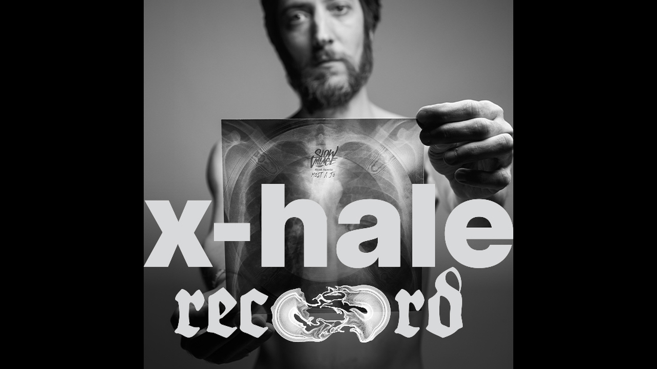 X-hale Record - Healthcare - Affidea Magyarország Kft.