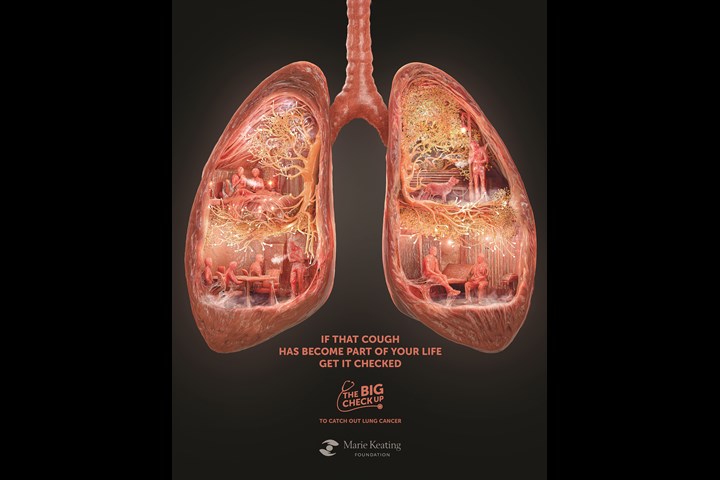 The First Poster To Catch Lung Cancer - Lung Cancer Awareness - Marie Keating Foundation