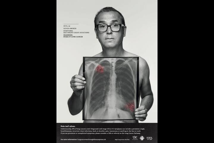 Lung Cancer 'See through the Symptoms' - Design for good - Engine Creative