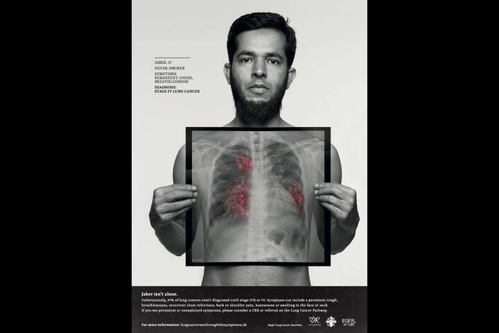 Lung Cancer 'See through the Symptoms' - Design for good - Engine Creative