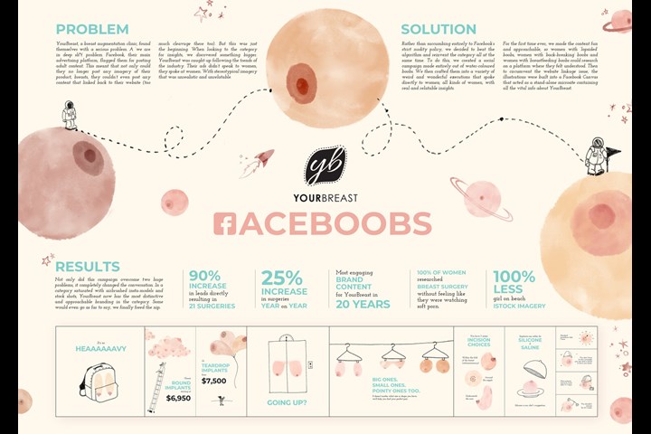 Faceboobs - Breast Augmentation - YourBreast