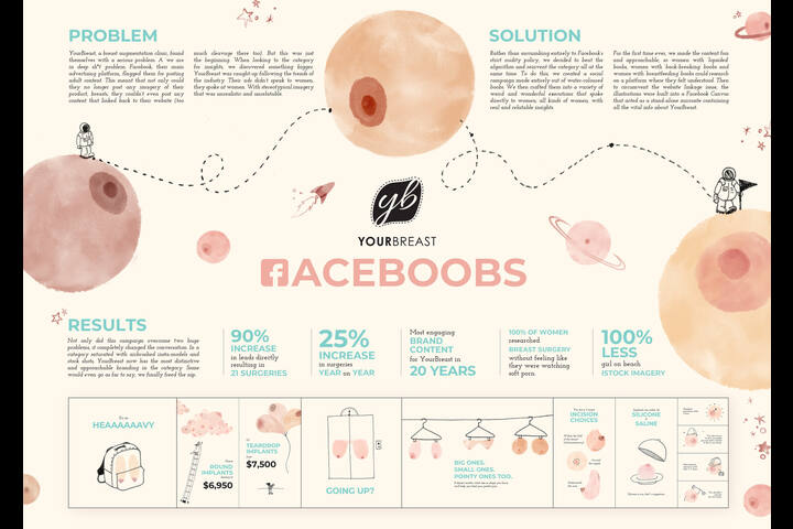 Faceboobs - Breast Augmentation - YourBreast